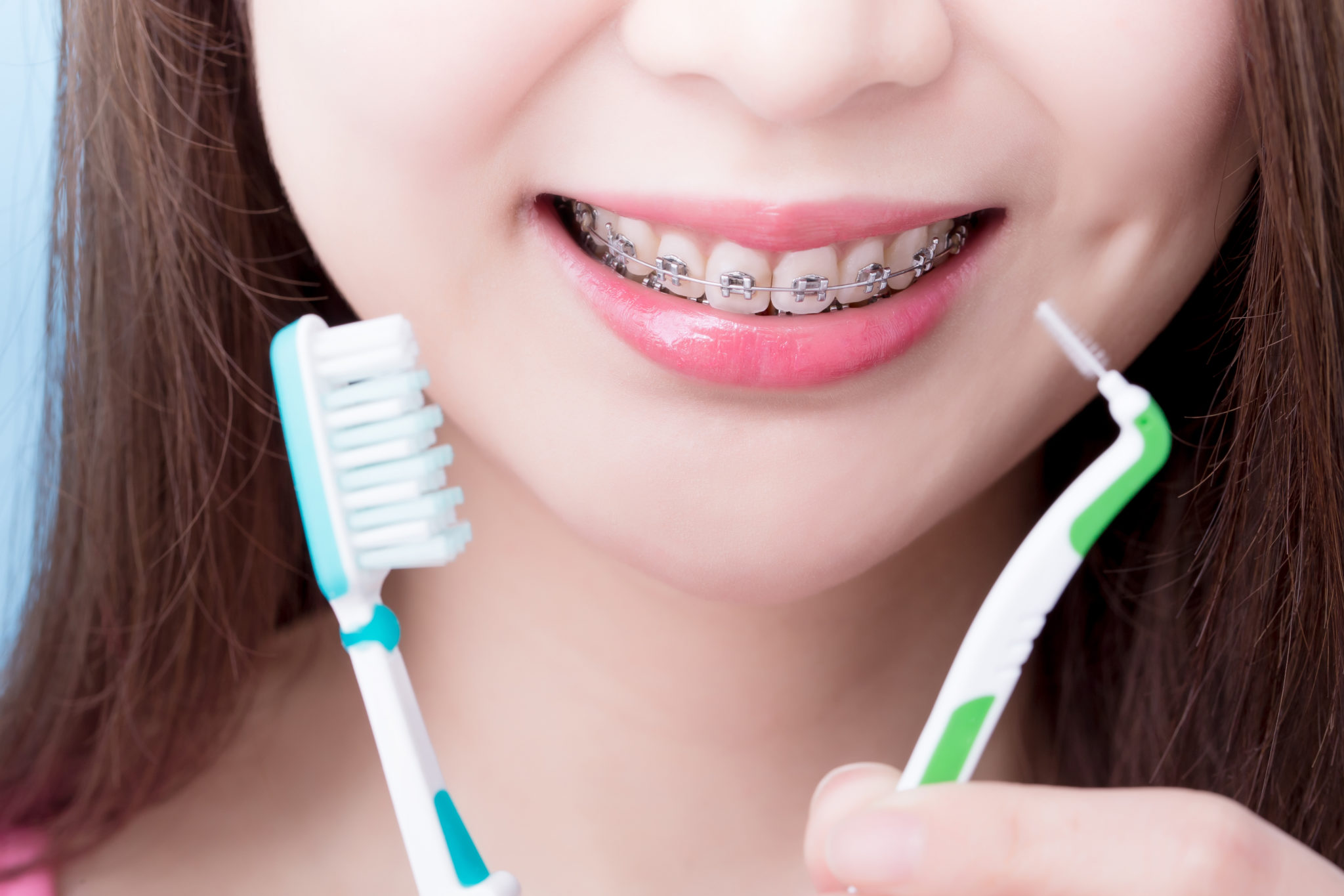 Stay At Home Care for Braces Tisseront Orthodontics