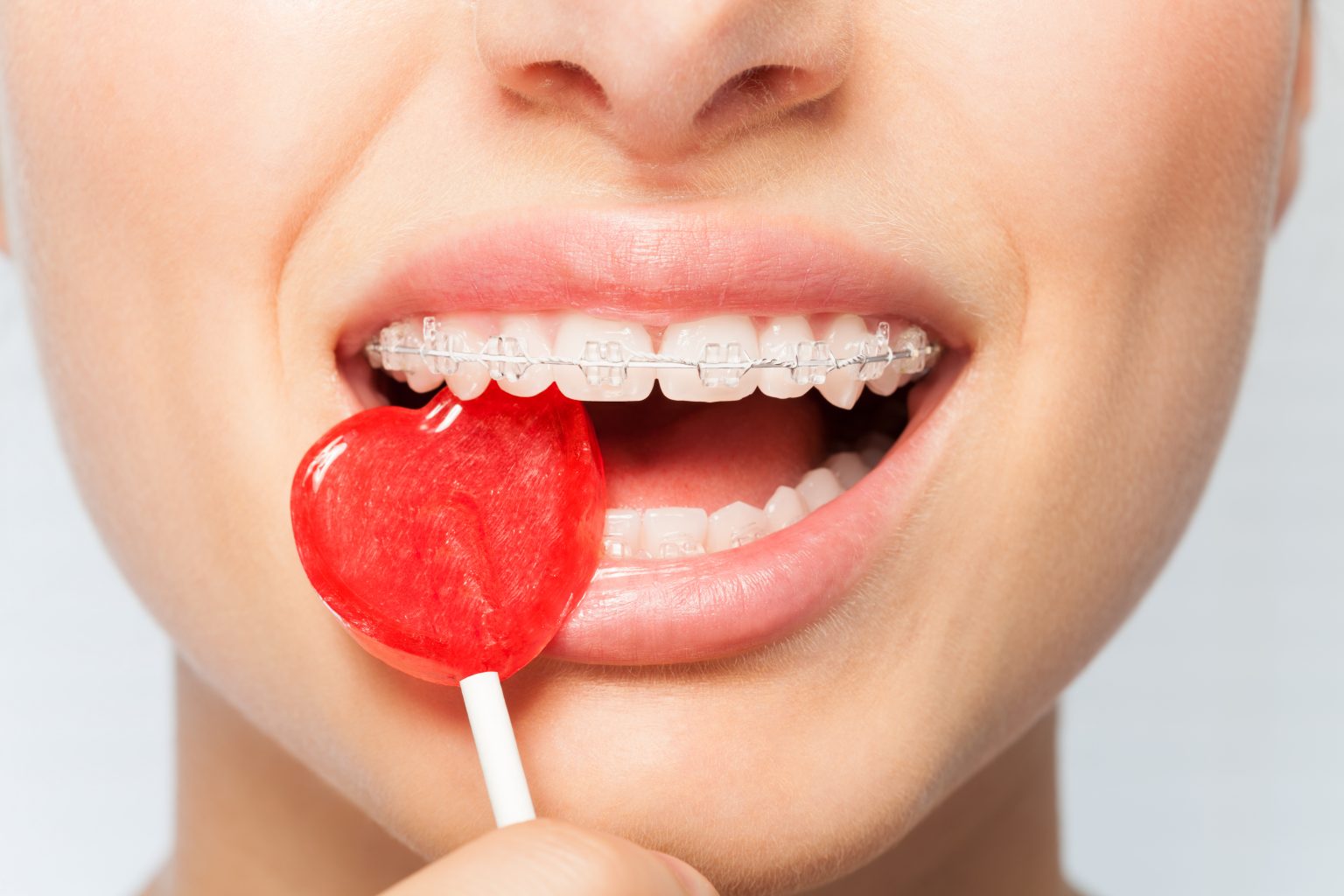 Why Does Sugar Hurt Your Teeth Tisseront Orthodontics