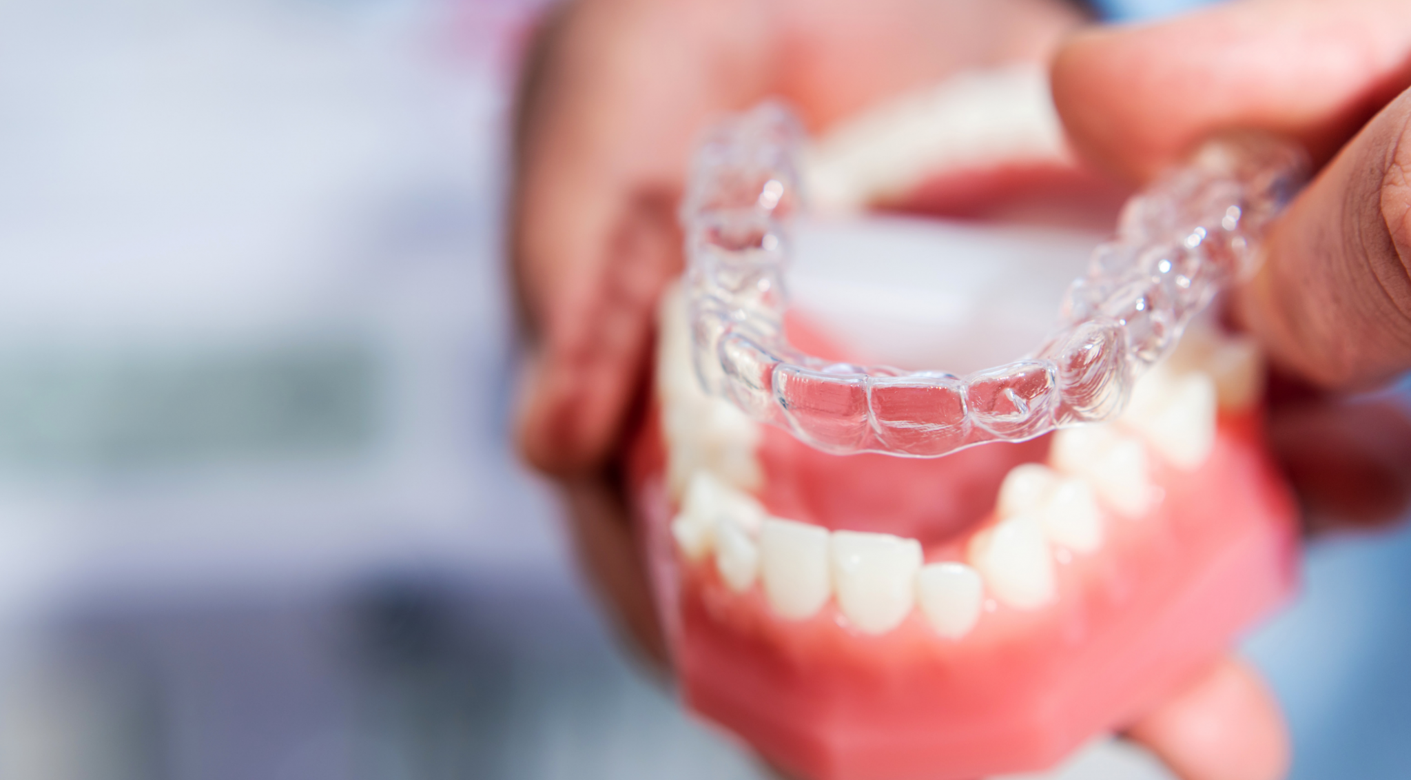 Invisalign Not Tracking? Try Our Tips! Orthrodontic