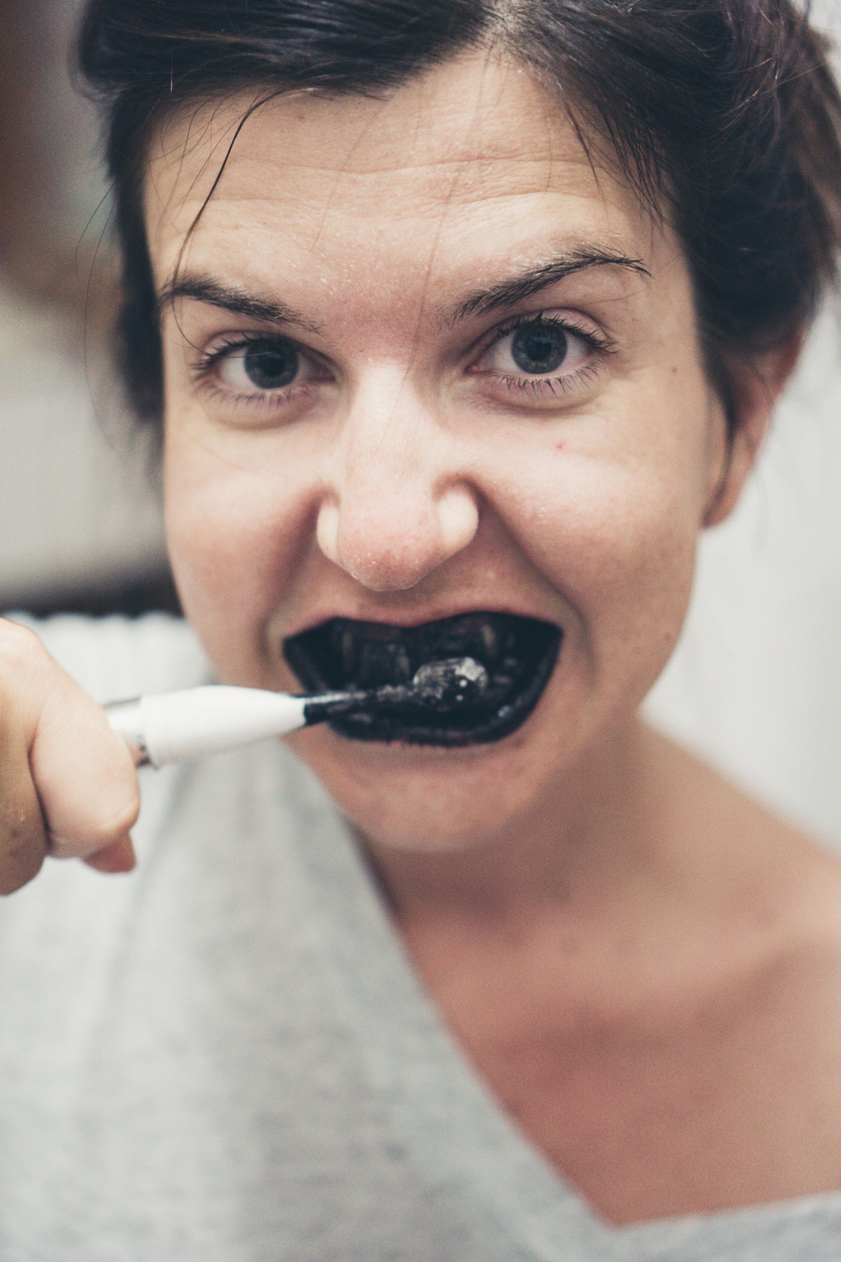 How to Whiten Teeth With Braces? Can You?